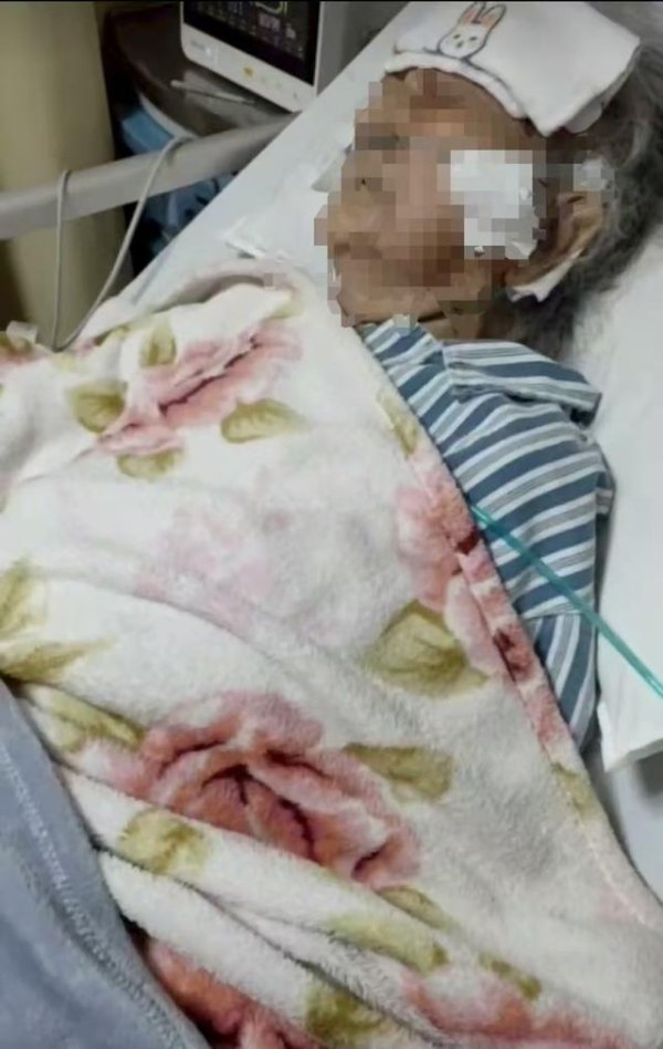 易配宝 82岁老太“能说能笑住院检查”，12天后病情恶化不治身亡；司法鉴定院方担同责，亲属获赔21.8万认为应追责